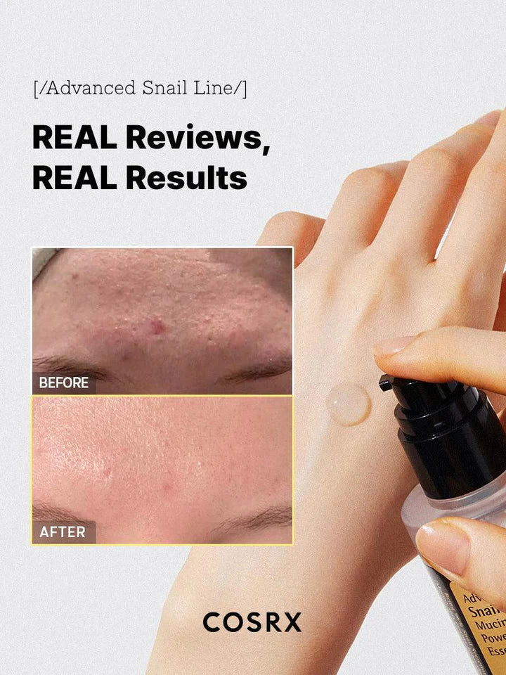 COSRX Advanced Snail 96 Mucin Power Essence 100ml | Hydrating Korean Skincare Serum